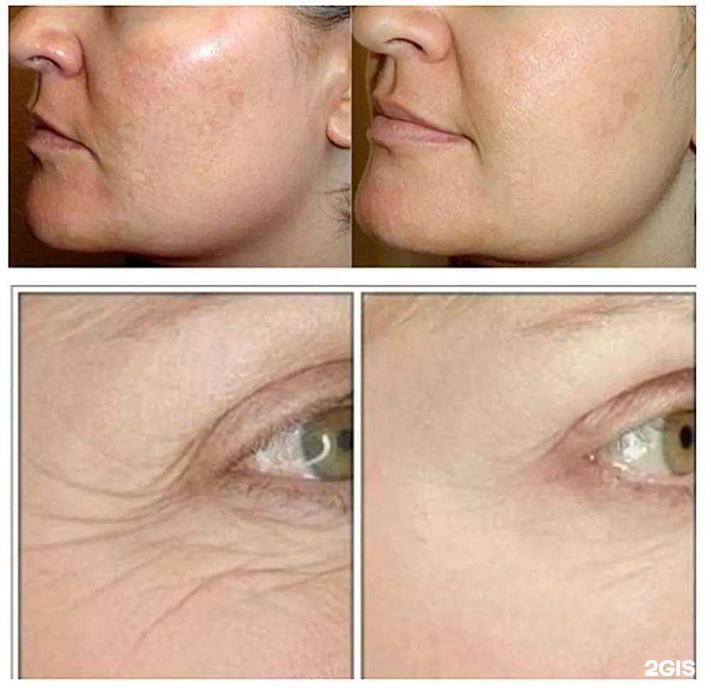 Отзывы на компанию Лав в Анапе c фото