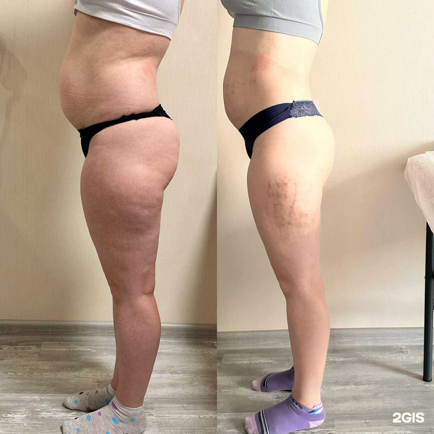 Отзывы на компанию Butterfly lpg в Тюмени c фото