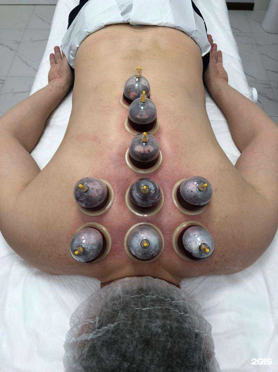 Отзывы на компанию Хиджама Сунна в Казани c фото