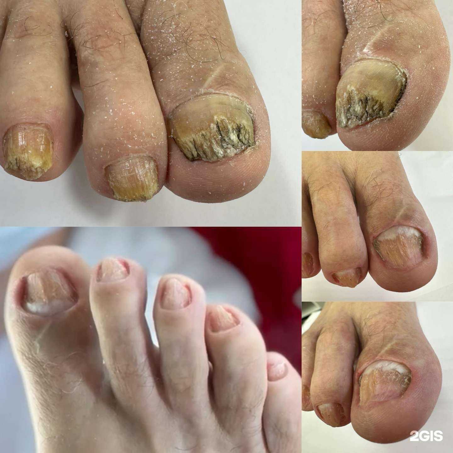 Отзывы на компанию Nail_fisik в Краснодаре c фото