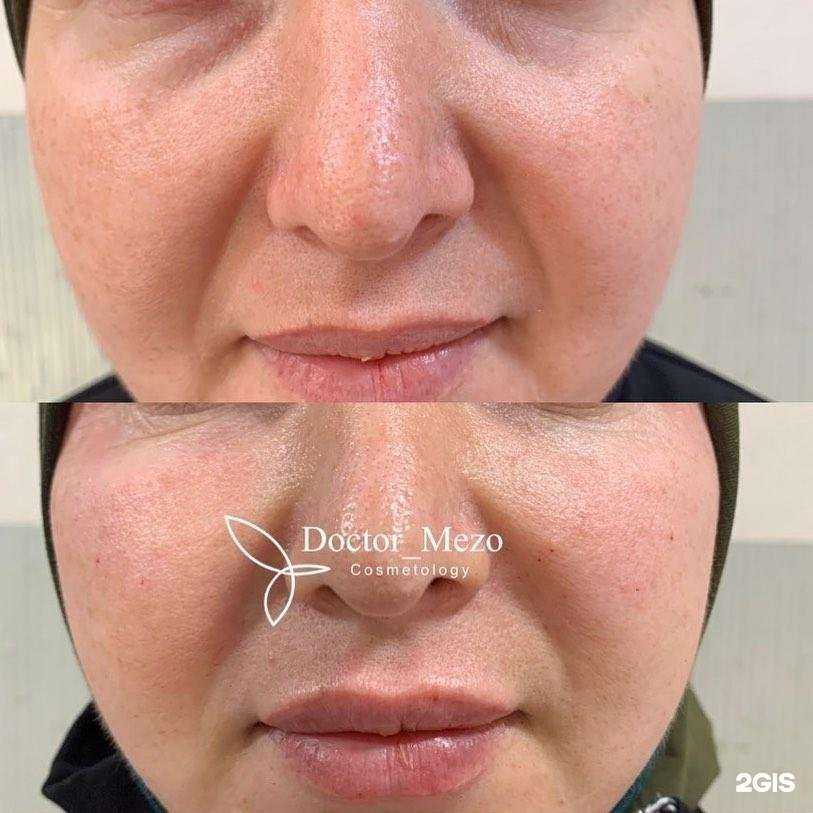 Отзывы на компанию Dr.Mezo в г. Махачкала c фото