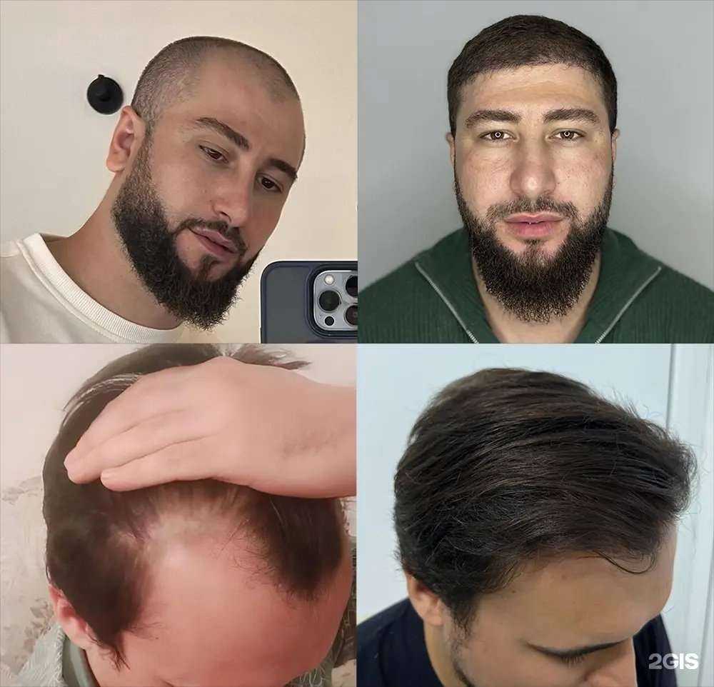 Отзывы на компанию Anvar.hair в Махачкале c фото