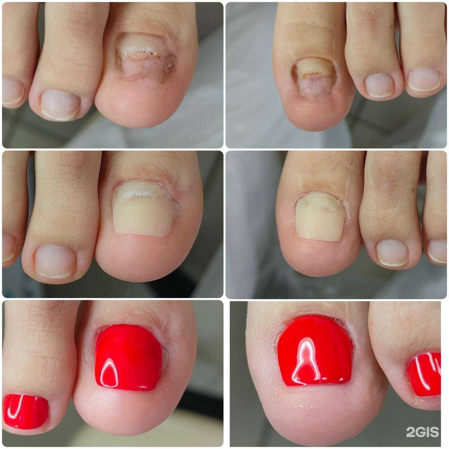 Отзывы на компанию Подолог Кедрина в г. Анапа c фото