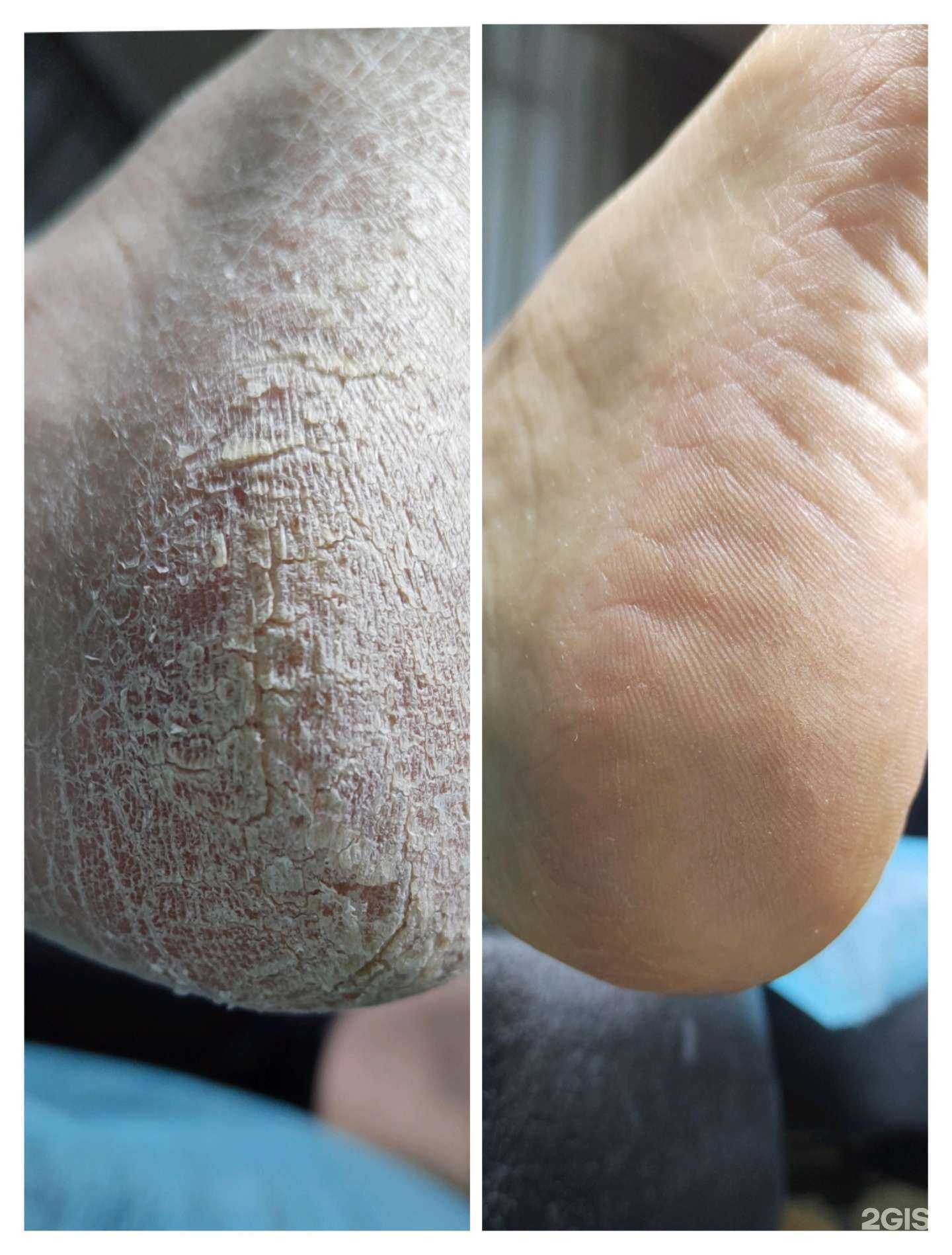 Отзывы на компанию Кабинет педикюра и услуг подолога в Набережных Челнах c фото