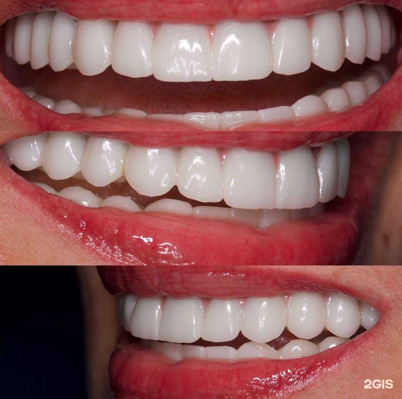 Отзывы на компанию Dental clinic Eldar Kubatov в г. Махачкала c фото