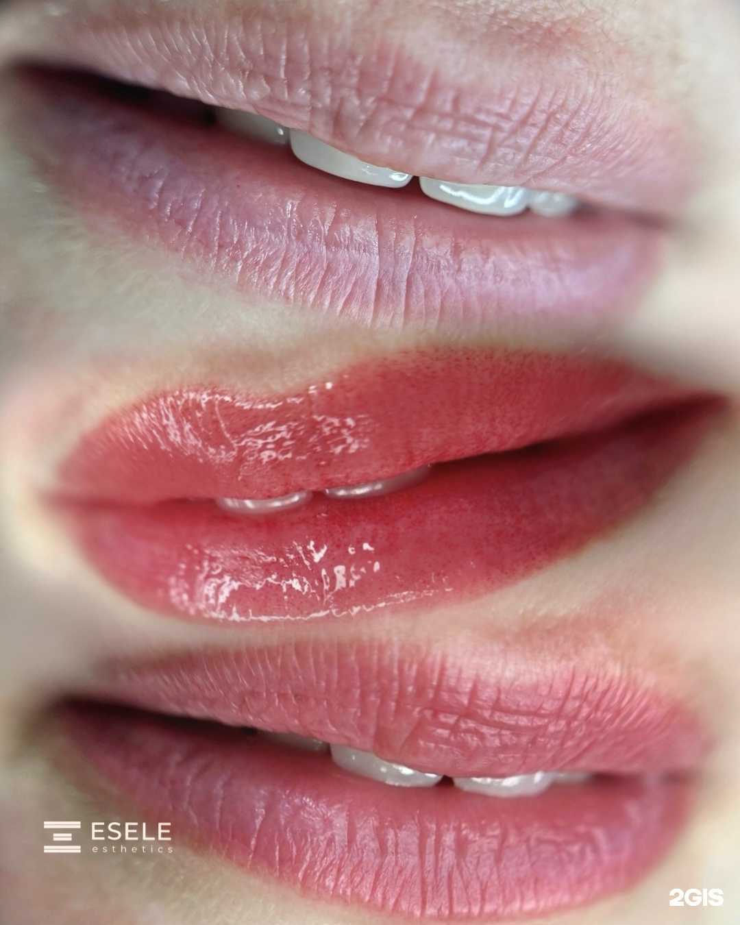 Отзывы на компанию Esele Esthetics by Eselevich в Новосибирске c фото