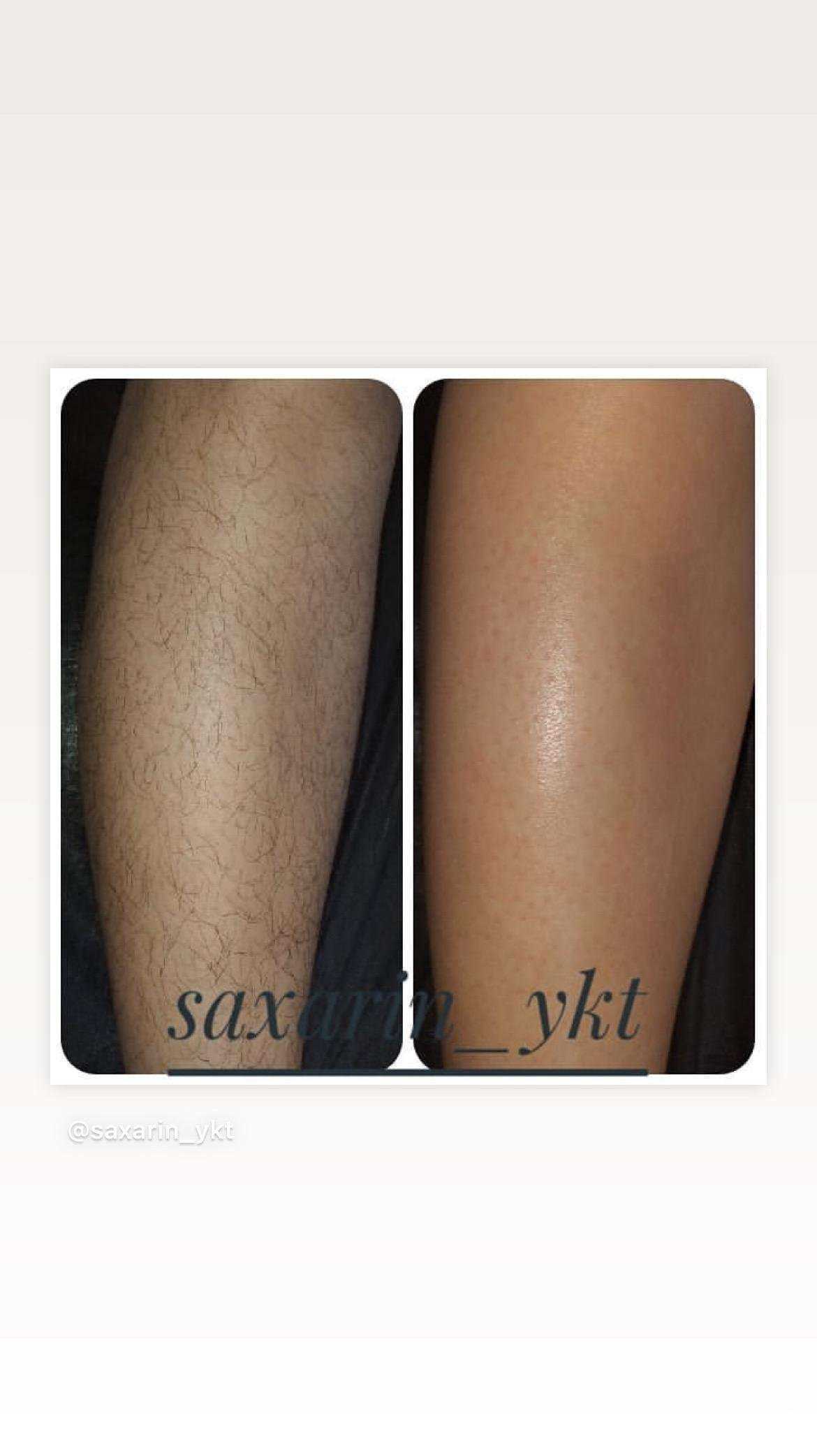 Отзывы на компанию Сахарин в Якутске c фото