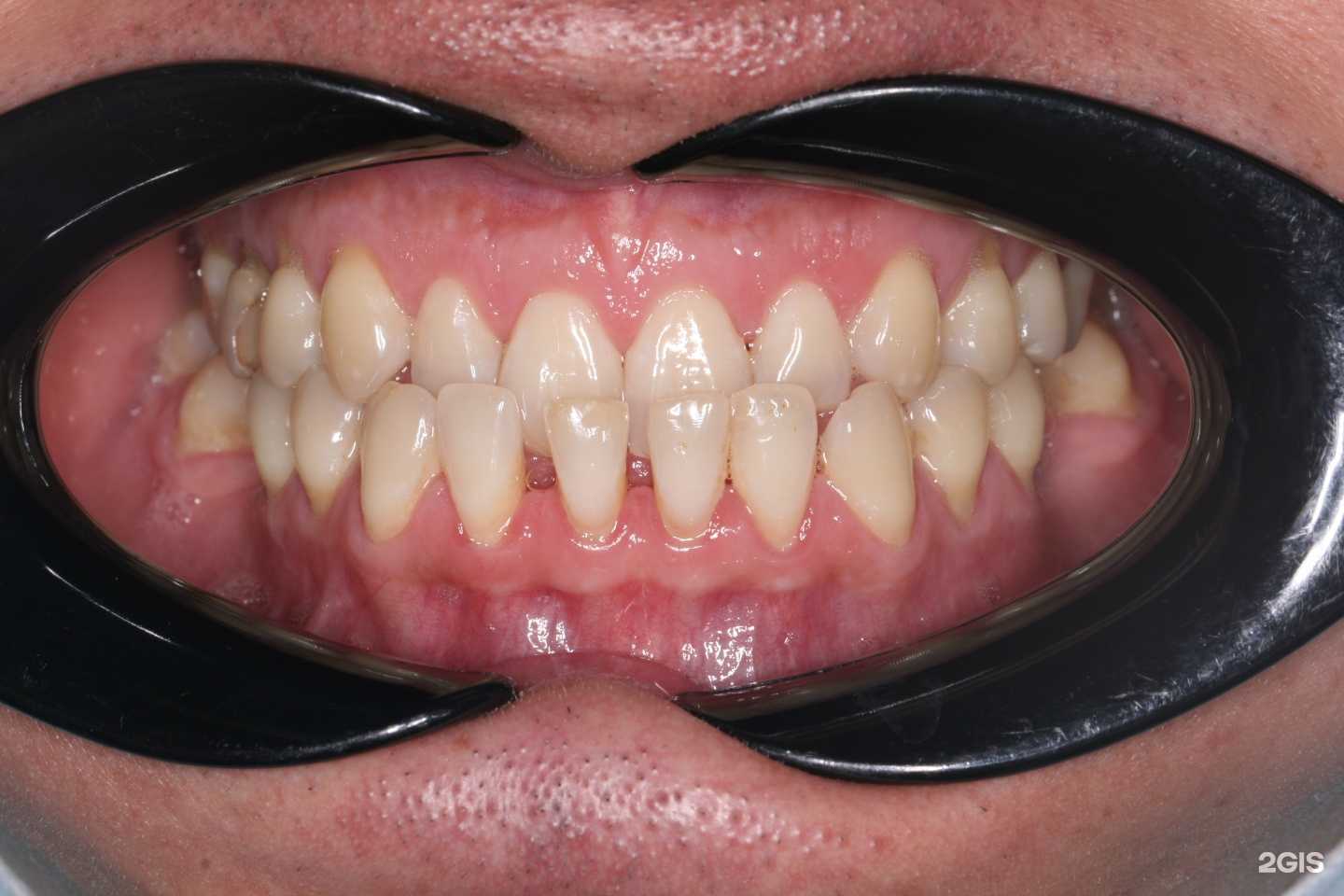 Отзывы на компанию Ортодонтическая клиника доктора Гаврилова  в г. Стерлитамак c фото