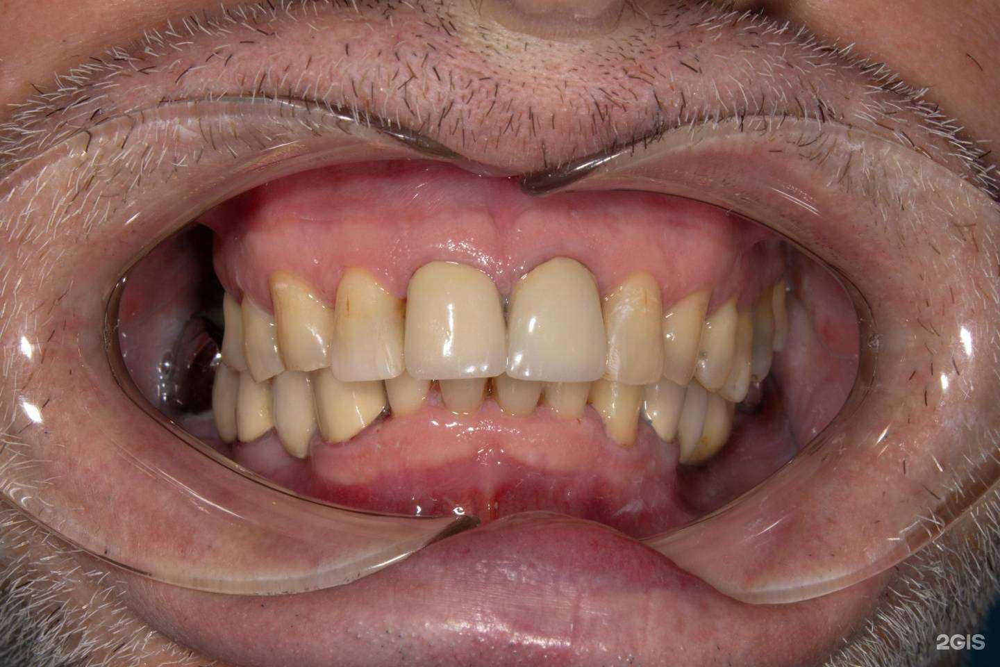 Отзывы на компанию Новая стоматологическая клиника в г. Самара c фото