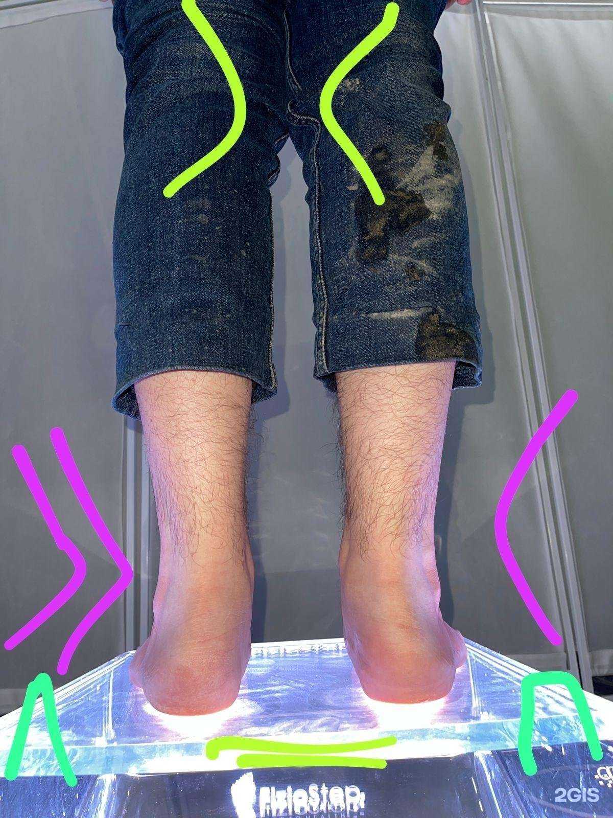 Отзывы на компанию Fiziostep-Orto в Казани c фото