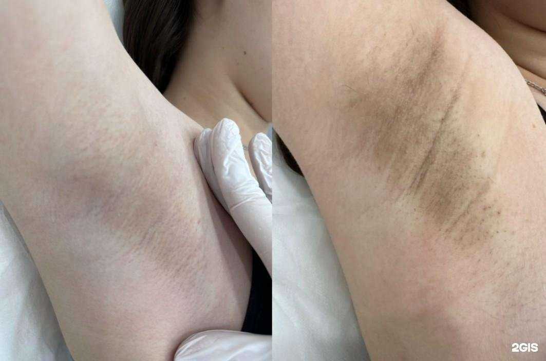 Отзывы на компанию ProfLaser в Новосибирске c фото