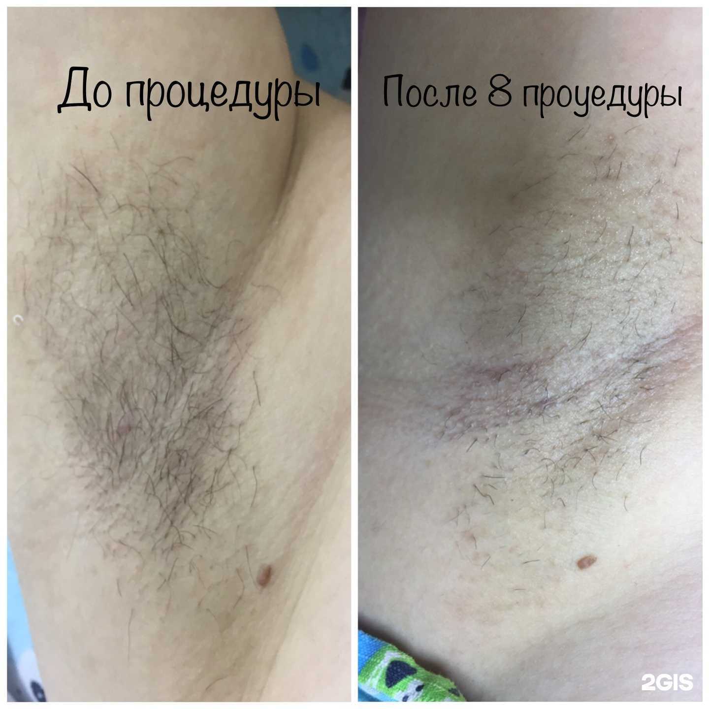 Отзывы на компанию Epigars в Кирове c фото