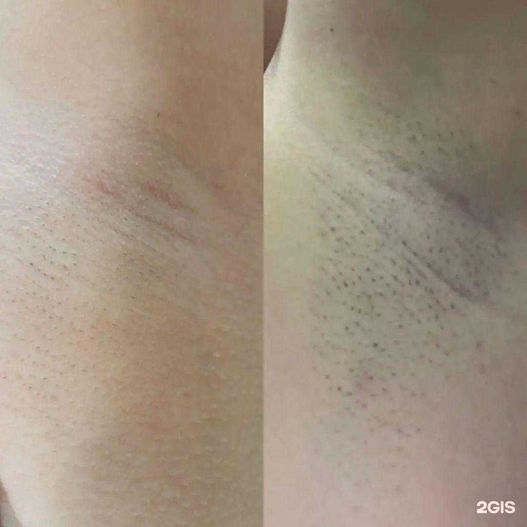 Отзывы на компанию Beauty_laser_abakan в Абакане c фото