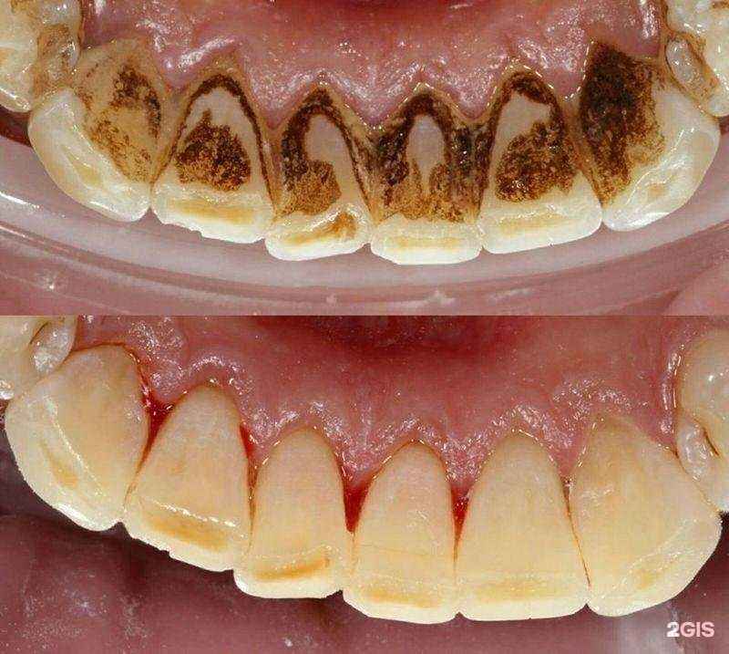 Отзывы на компанию Дантист в Первоуральске c фото