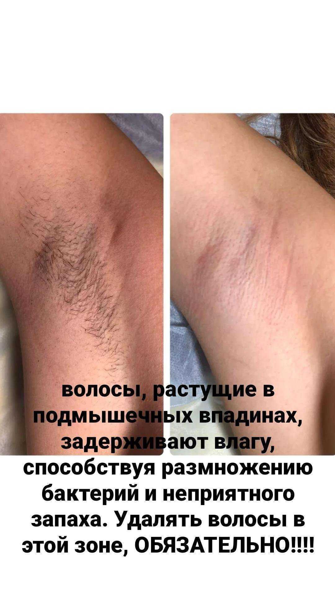 Отзывы на компанию Вау депиляция в Барнауле c фото