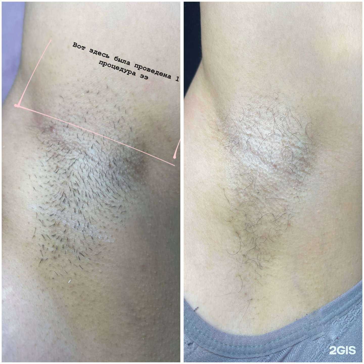 Отзывы на компанию Кабинет электроэпиляции в Ставрополе c фото