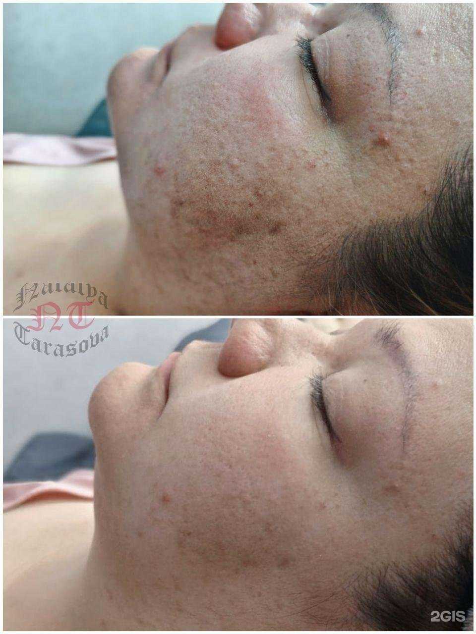 Отзывы на компанию Тебе повезло в г. Киров c фото