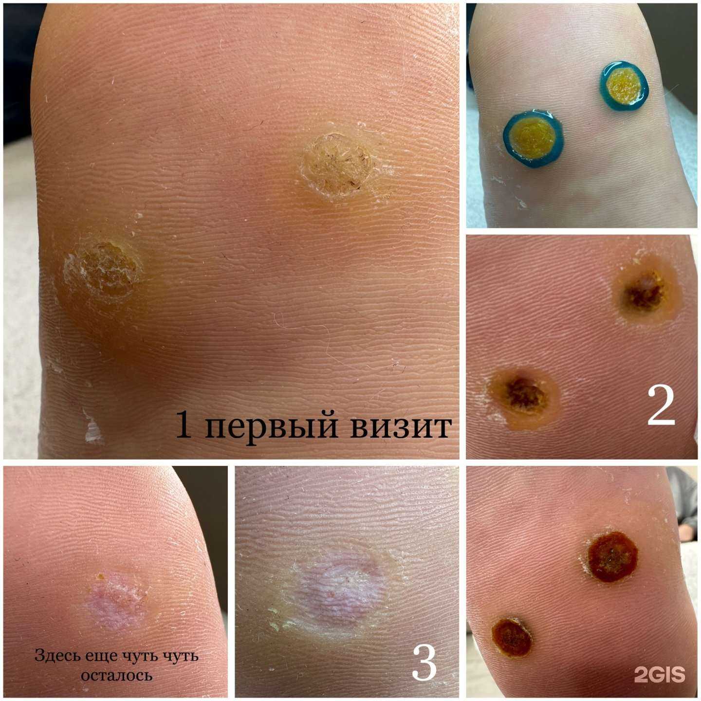 Отзывы на компанию Студия подологии и эстетики в г. Норильск c фото