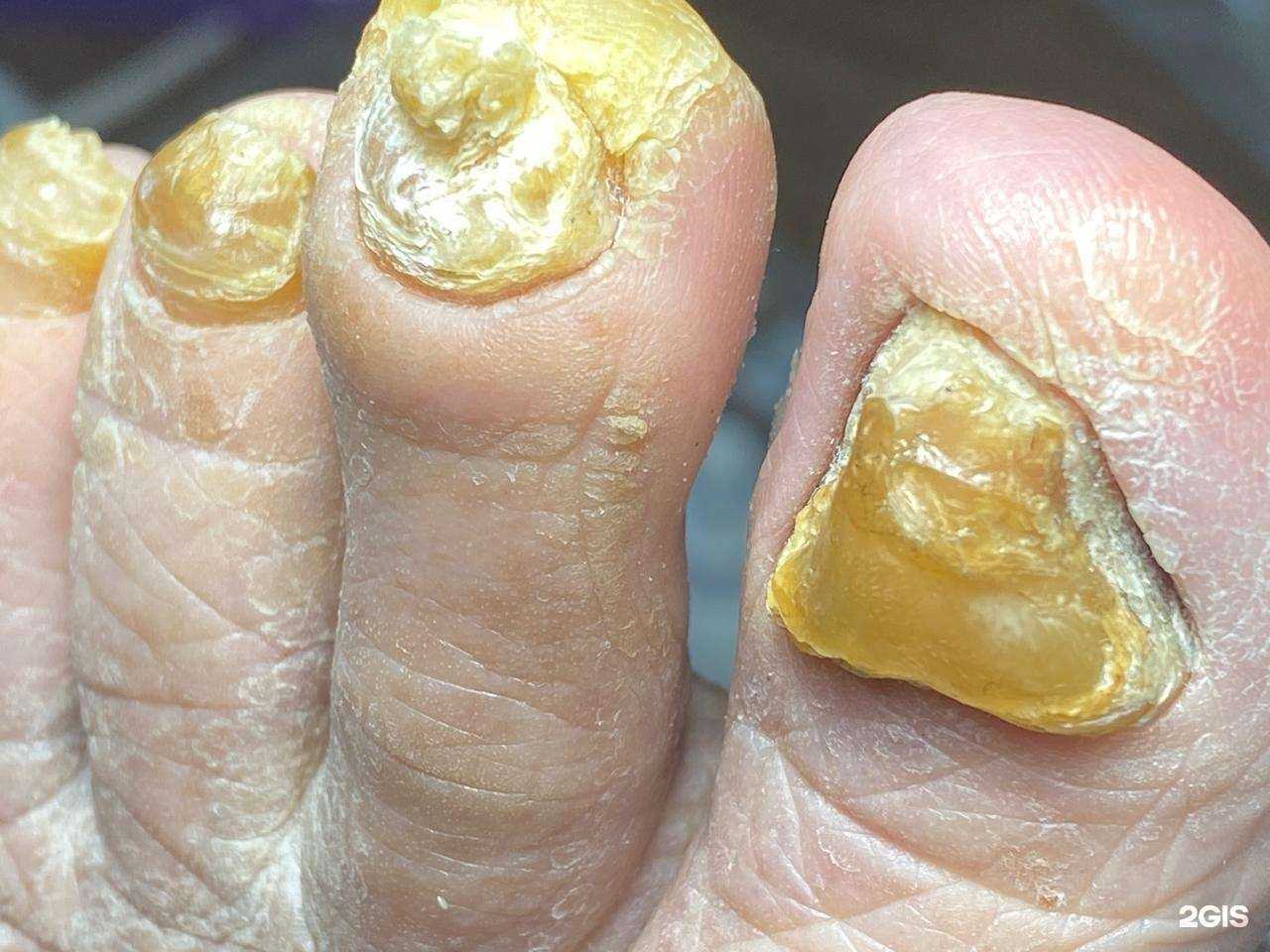 Отзывы на компанию Podolog_profi в Владивостоке c фото