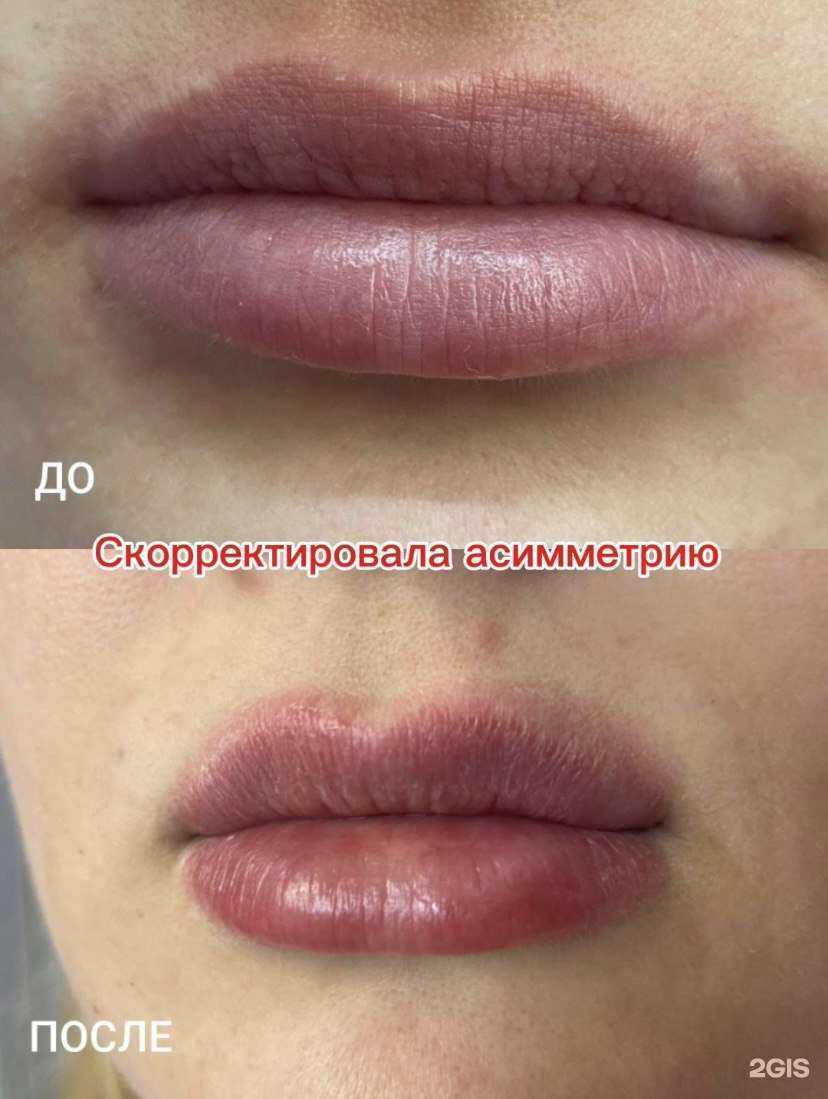 Отзывы на компанию Студия эстетической косметологии в г. Тольятти c фото