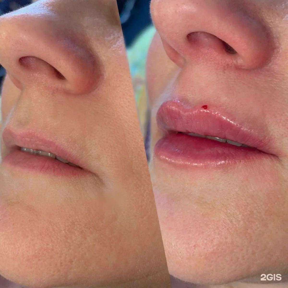 Отзывы на компанию Студия косметологии в Уфе c фото