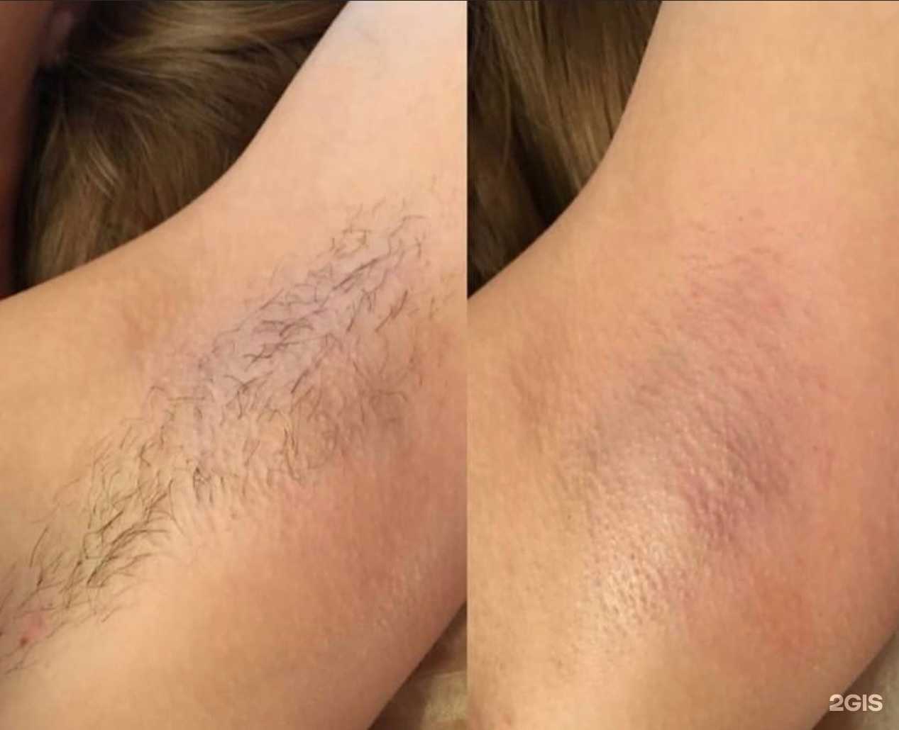 Отзывы на компанию Skin`s в г. Елизово c фото