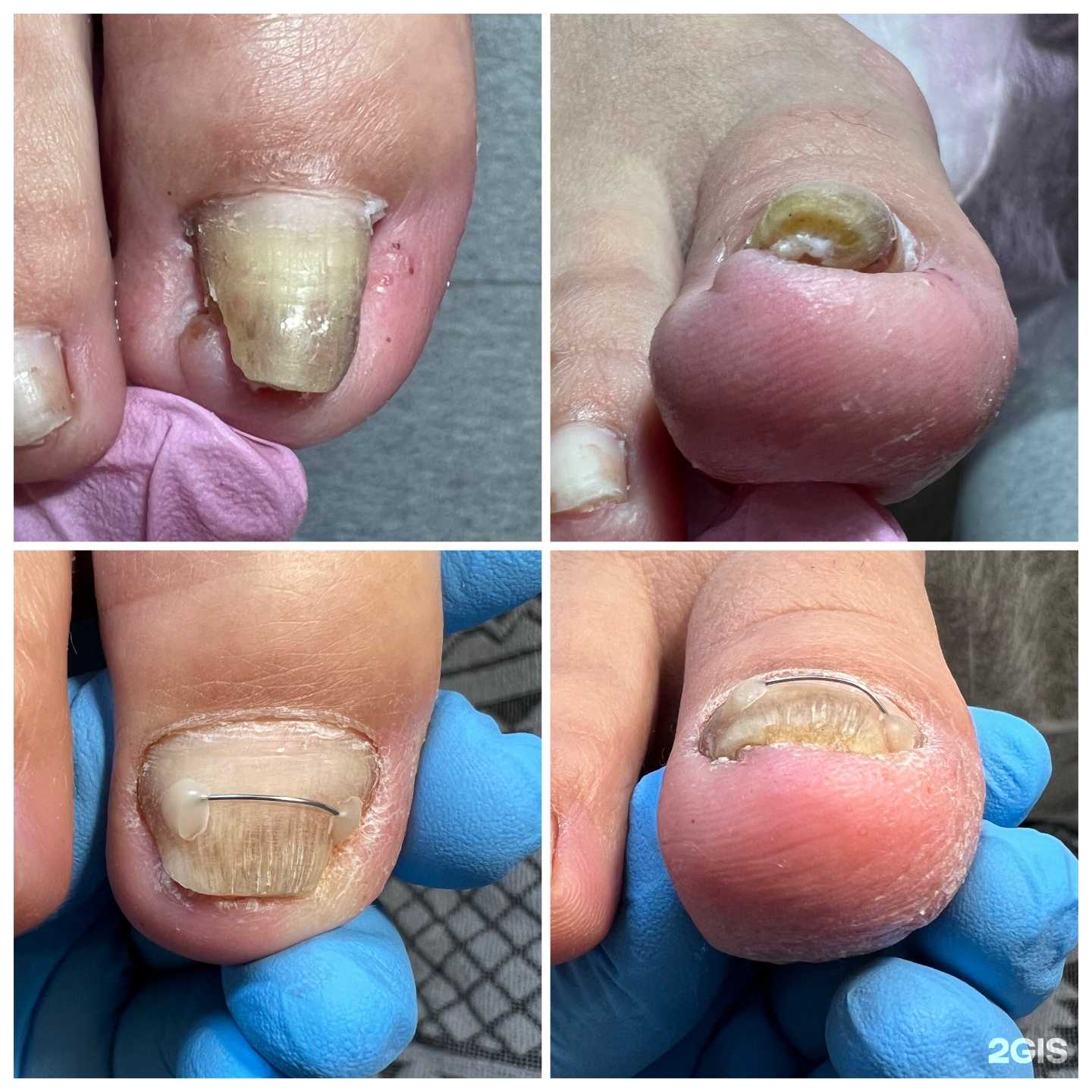 Отзывы на компанию Кабинет педикюра Малановой Татьяны в г. Иркутск c фото