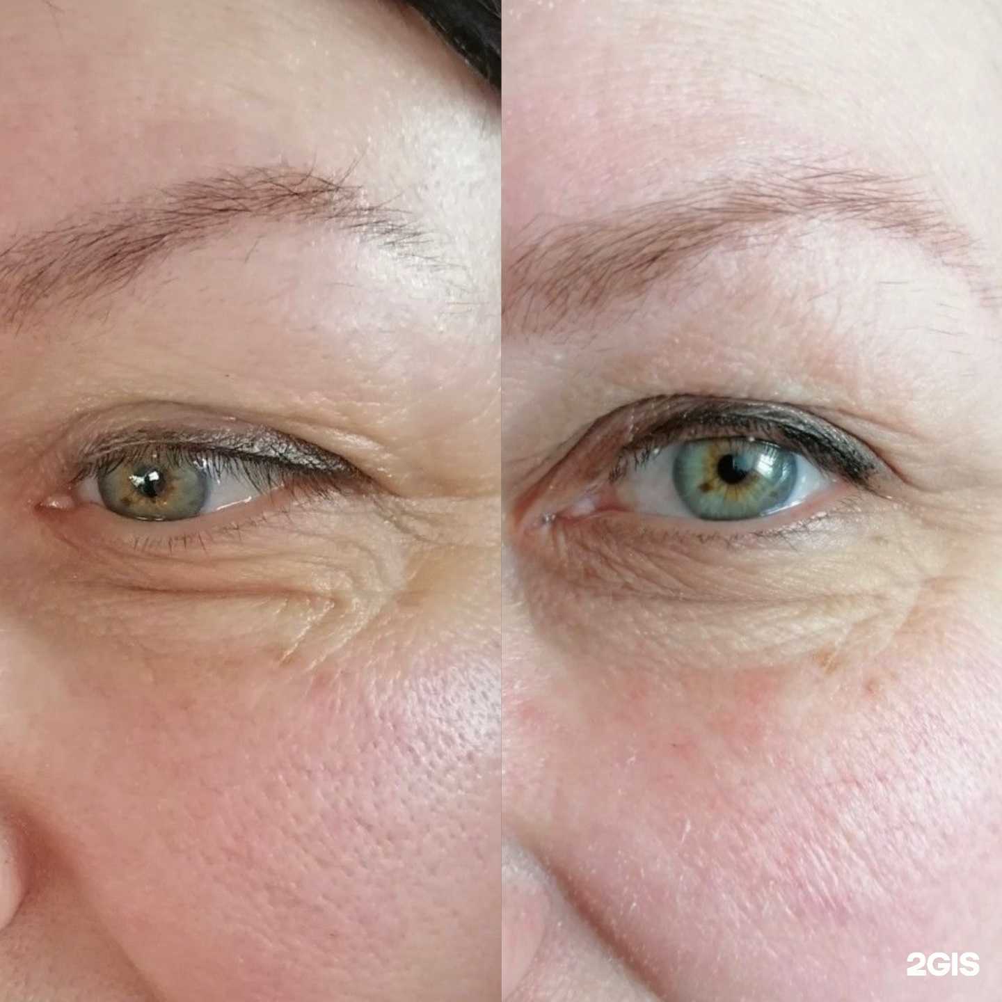 Отзывы на компанию Кабинет аппаратной косметологии в Тюмени c фото