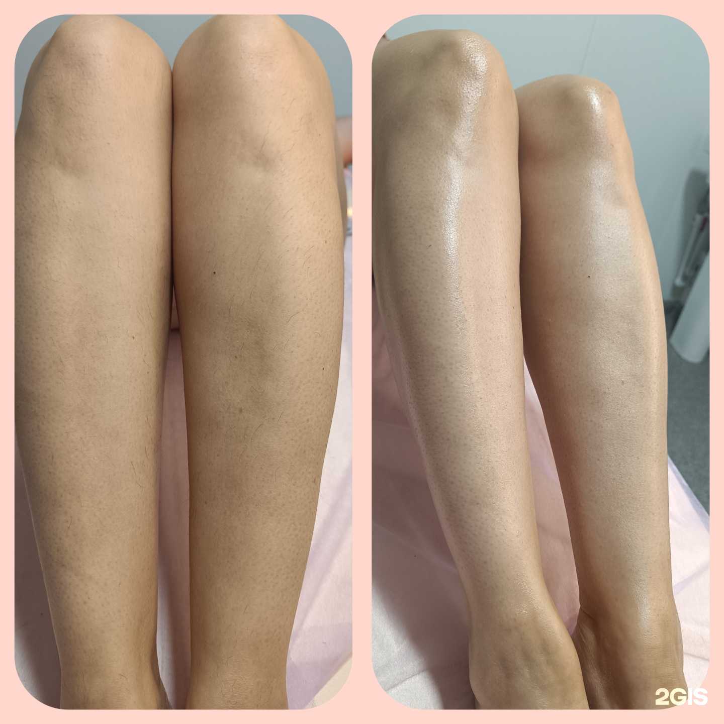 Отзывы на компанию Кабинет эпиляции в г. Челябинск c фото