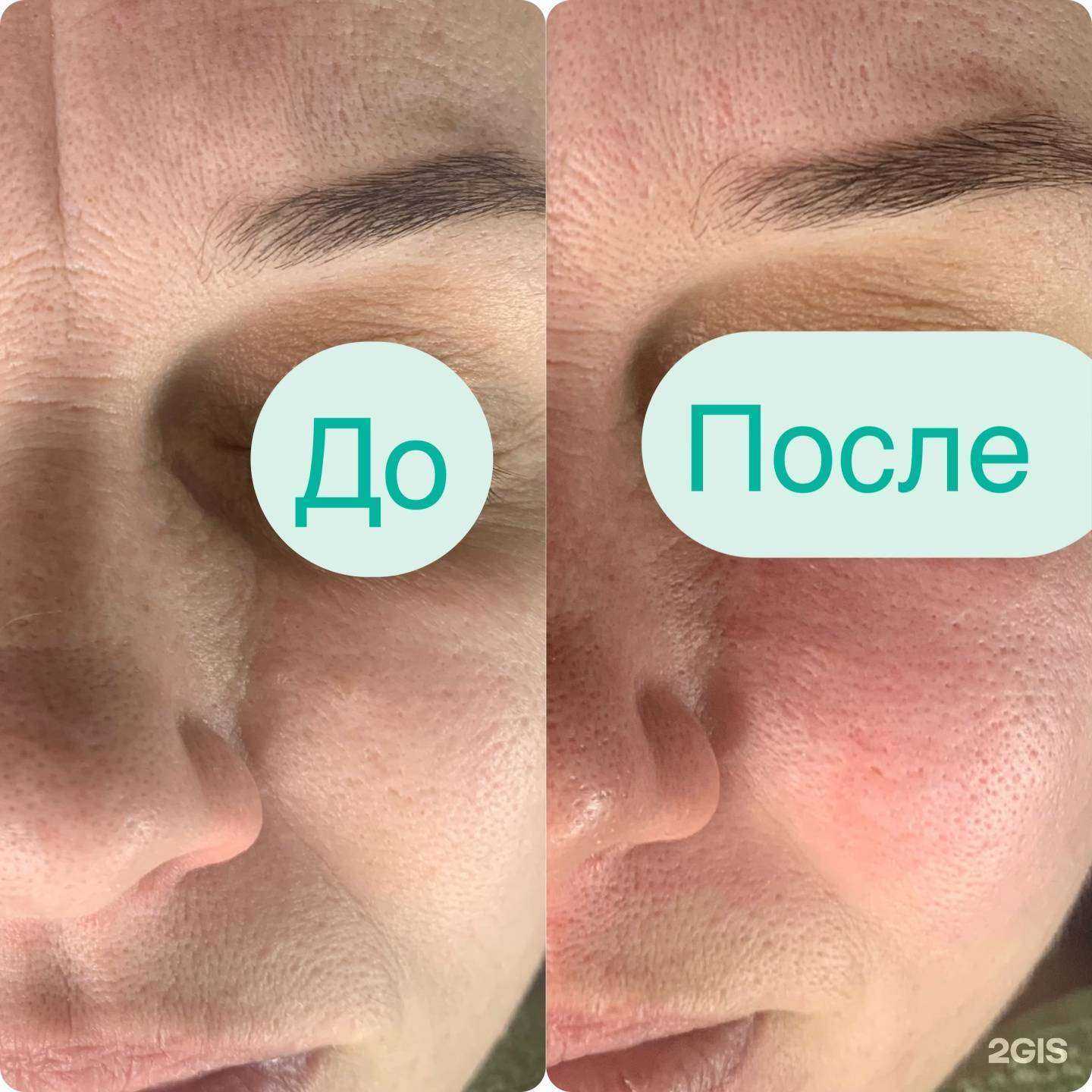 Отзывы на компанию Кабинет косметолога и эстетиста в Иркутске c фото