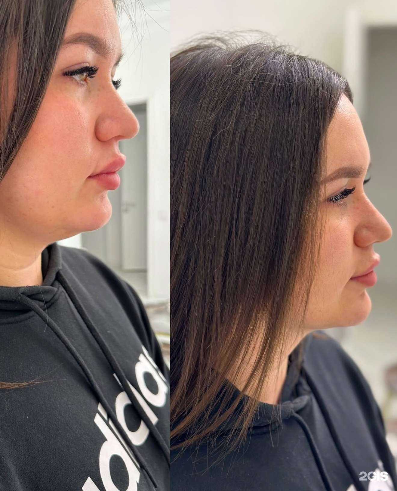 Отзывы на компанию Cosmetology в Краснодаре c фото