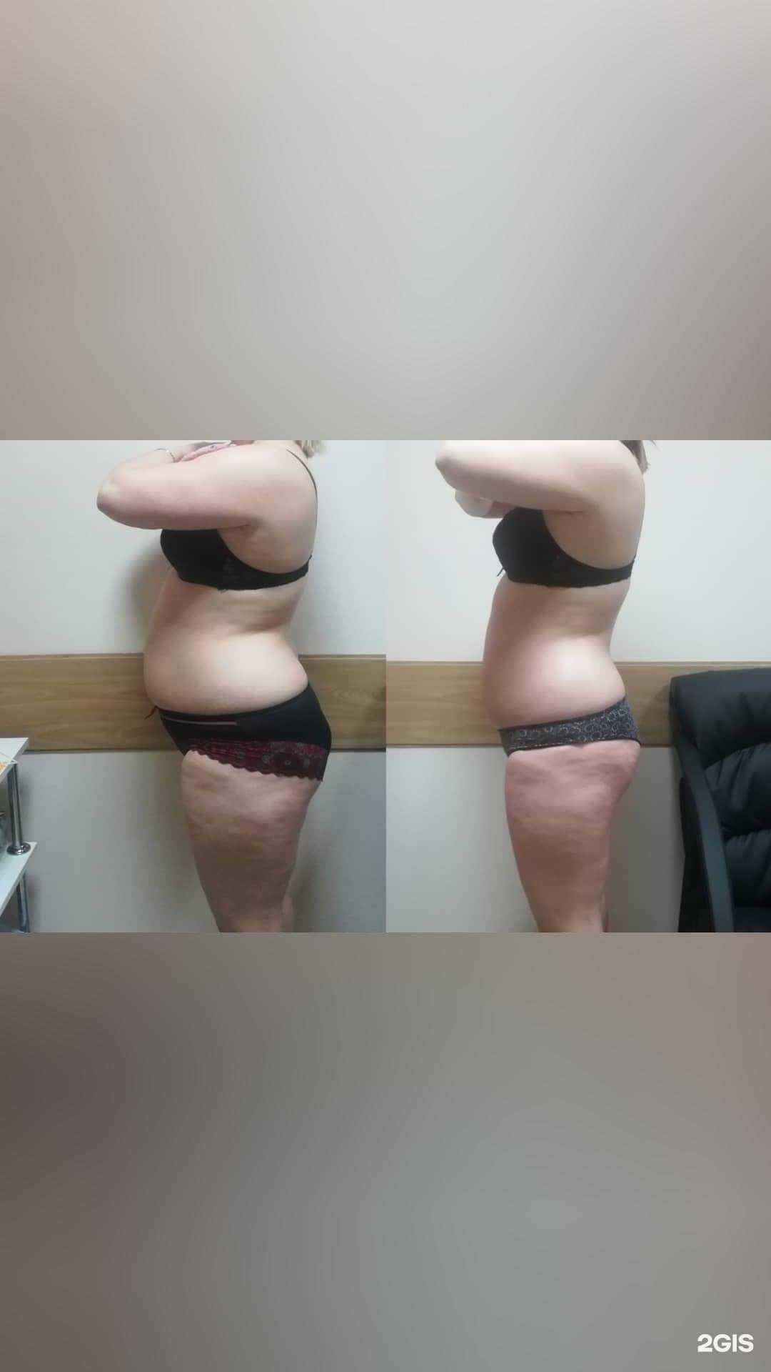 Отзывы на компанию Массажный кабинет в г. Новокузнецк c фото