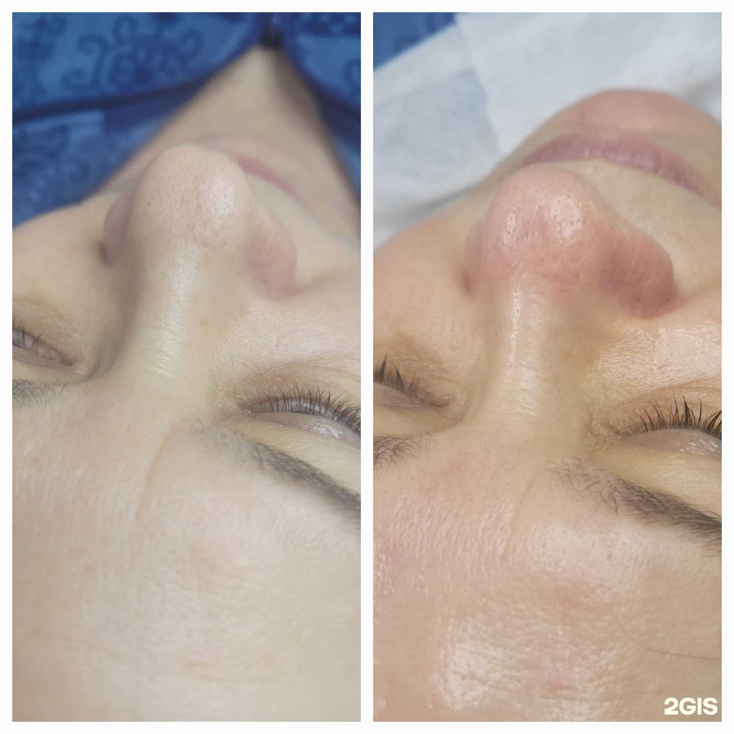 Отзывы на компанию Кабинет косметологии и лазерной эпиляции в г. Заринск c фото