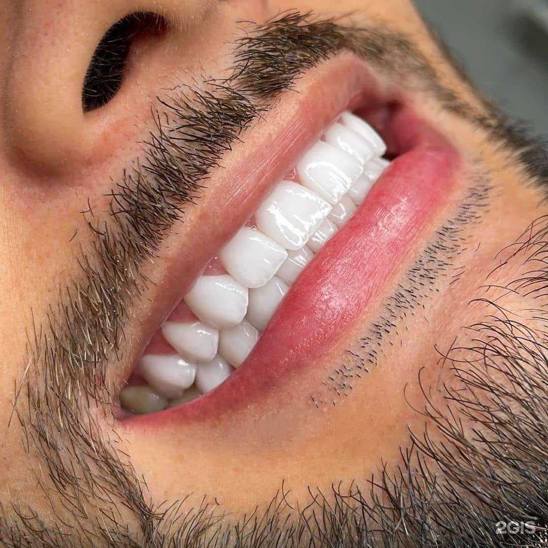 Отзывы на компанию Denta plus в г. Дербент c фото