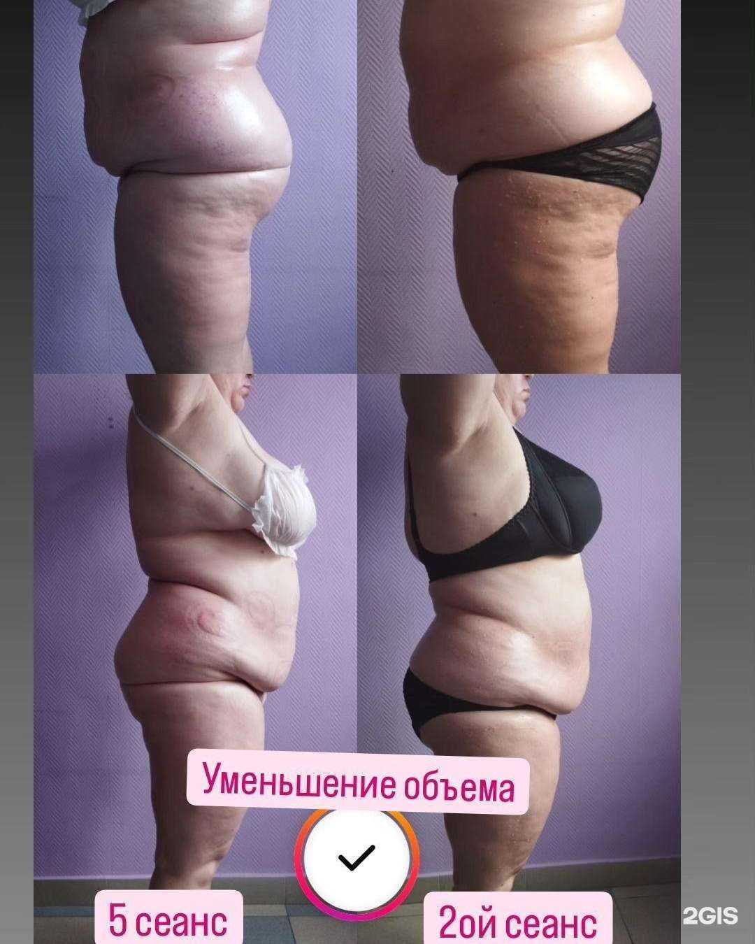 Отзывы на компанию Тонус в Прокопьевске c фото