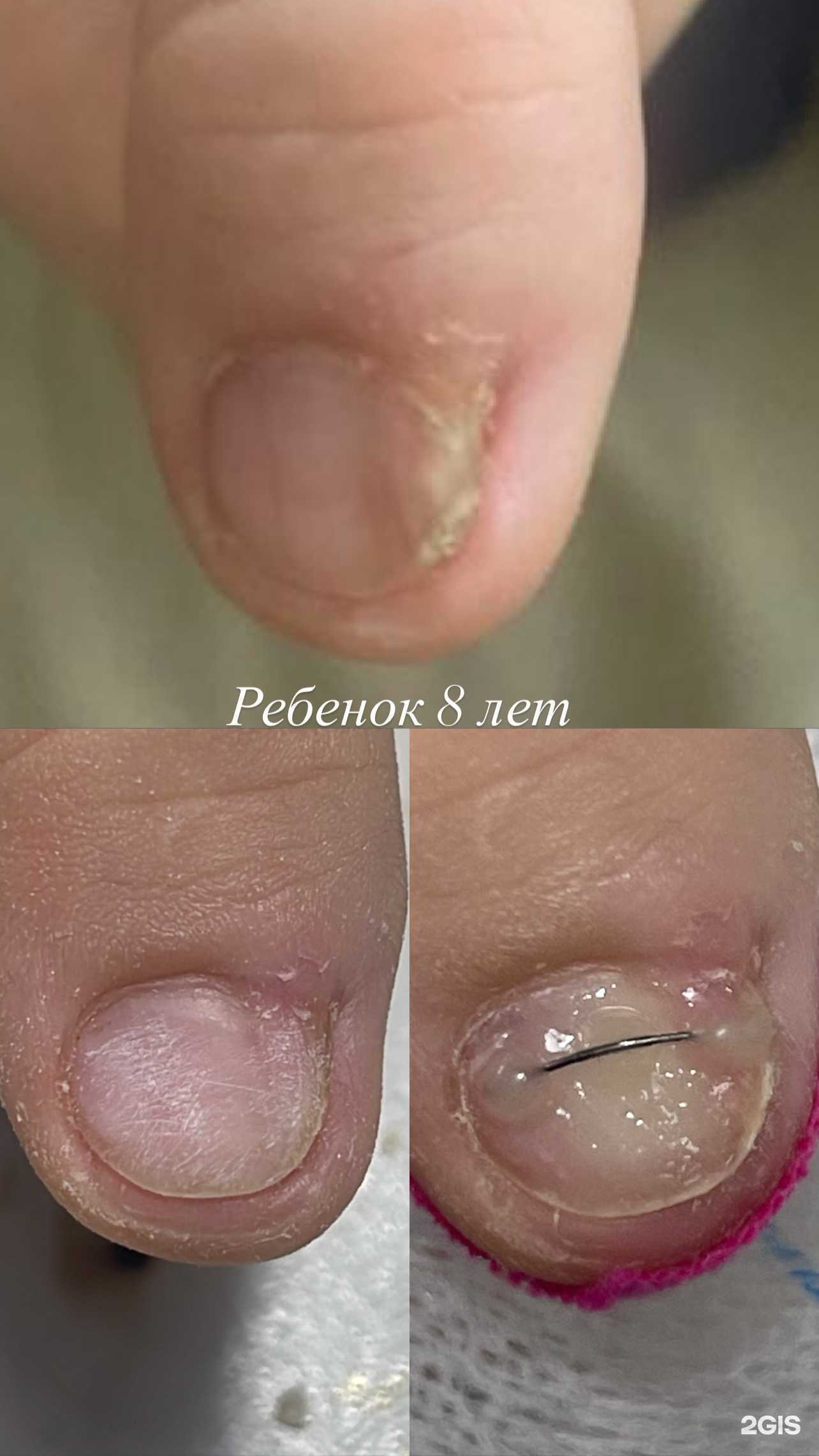 Отзывы на компанию ПодоЛекарь в Махачкале c фото