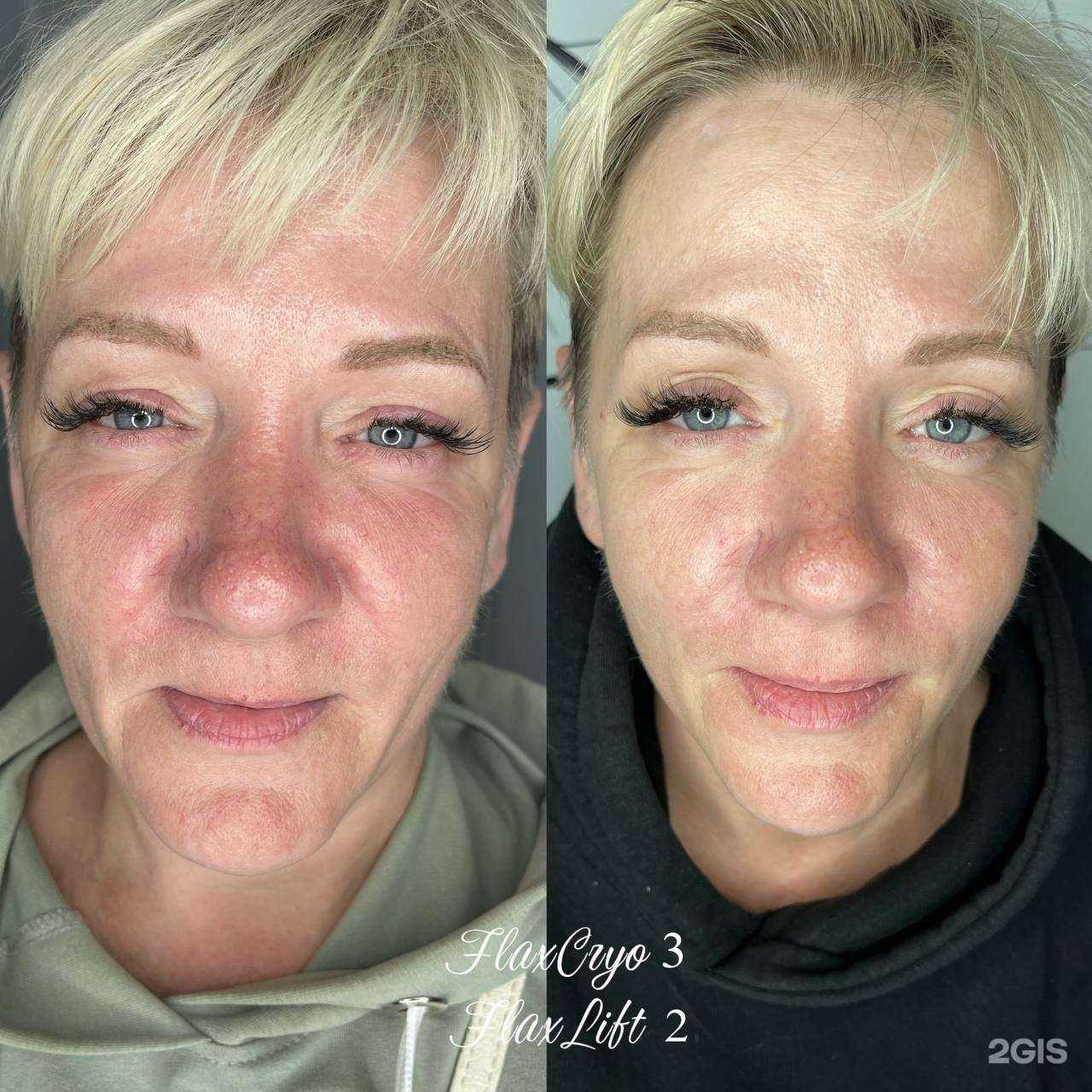 Отзывы на компанию Новая я в Волгограде c фото