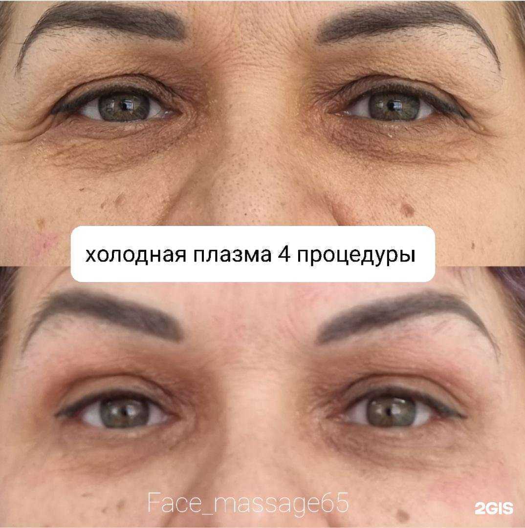 Отзывы на компанию Face_massage65 в Южно-Сахалинске c фото