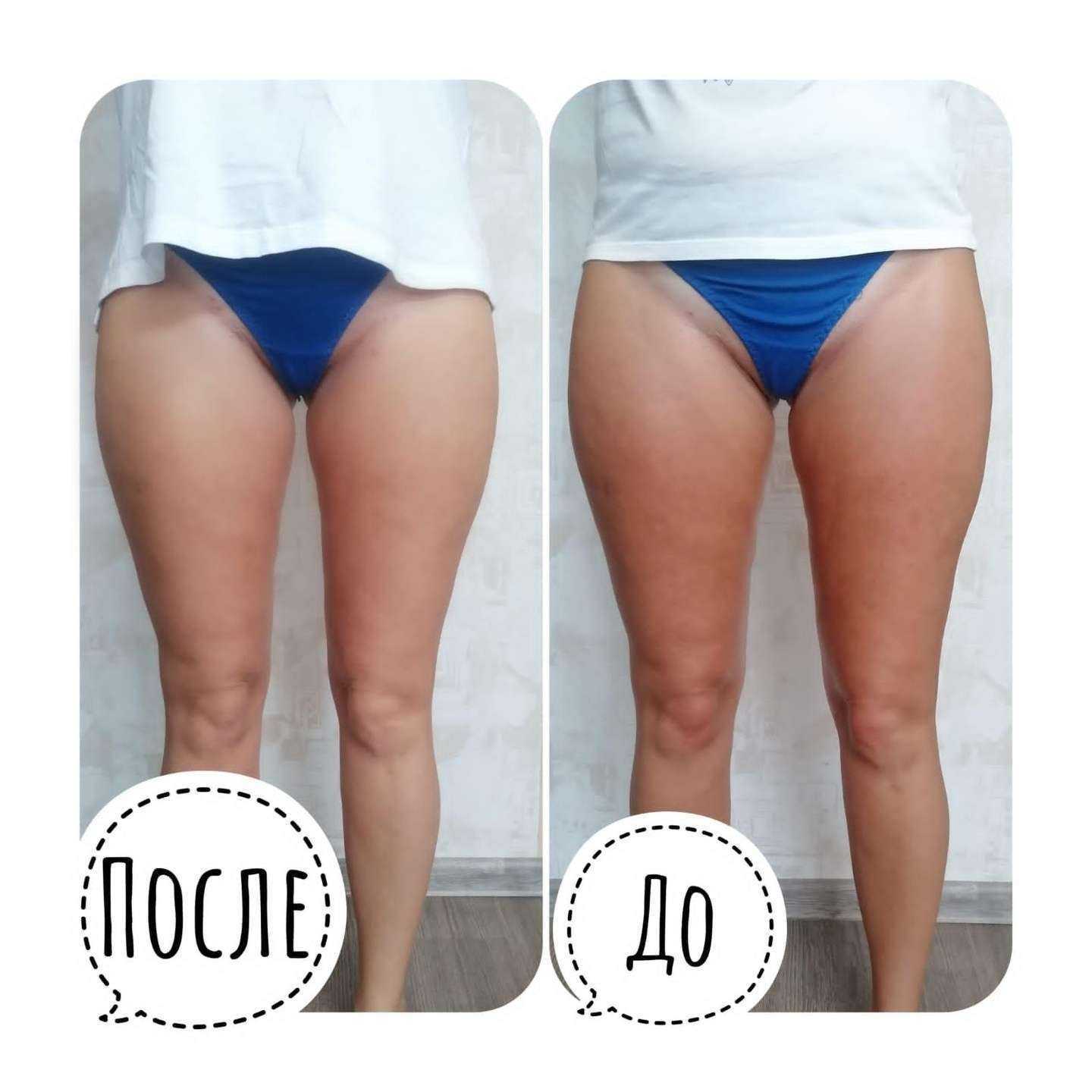 Отзывы на компанию Студия эпиляции и коррекции фигуры в Омске c фото