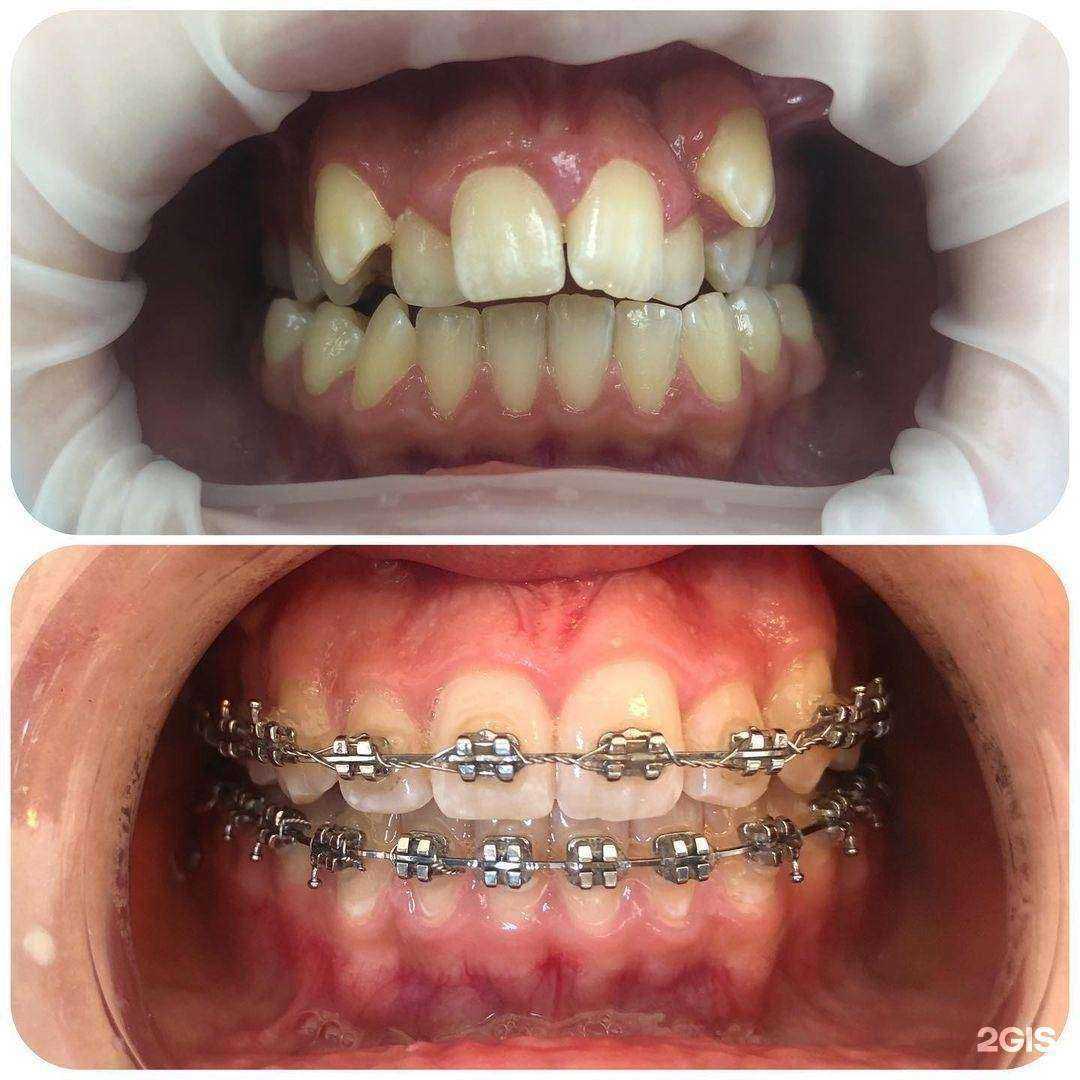 Отзывы на компанию Фэмили Дент в г. Чебоксары c фото