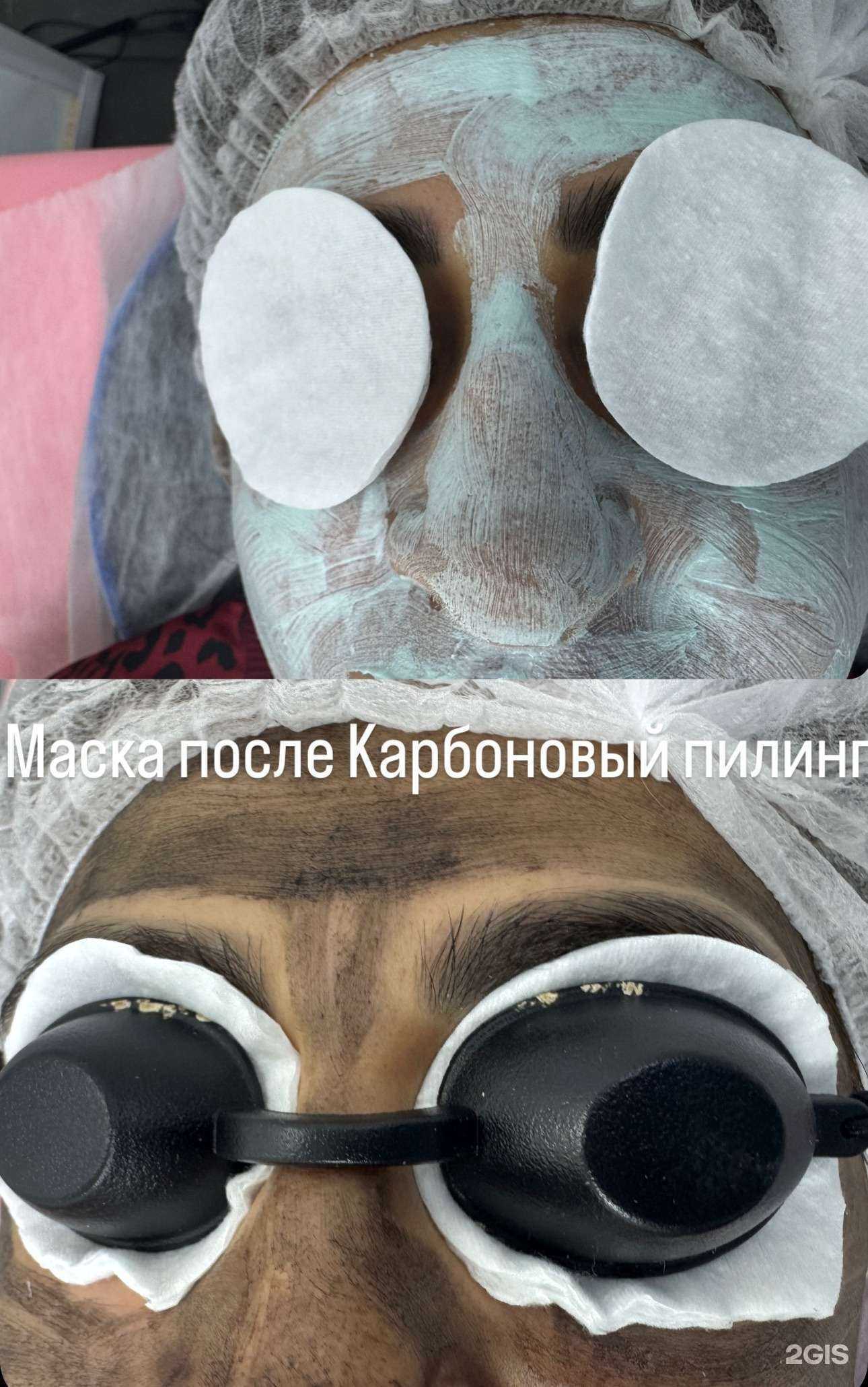 Отзывы на компанию GauLaser Beauty в Омске c фото