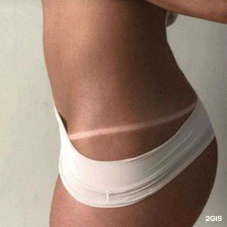 Отзывы на компанию Вертикальный турбо солярий в г. Калтан c фото