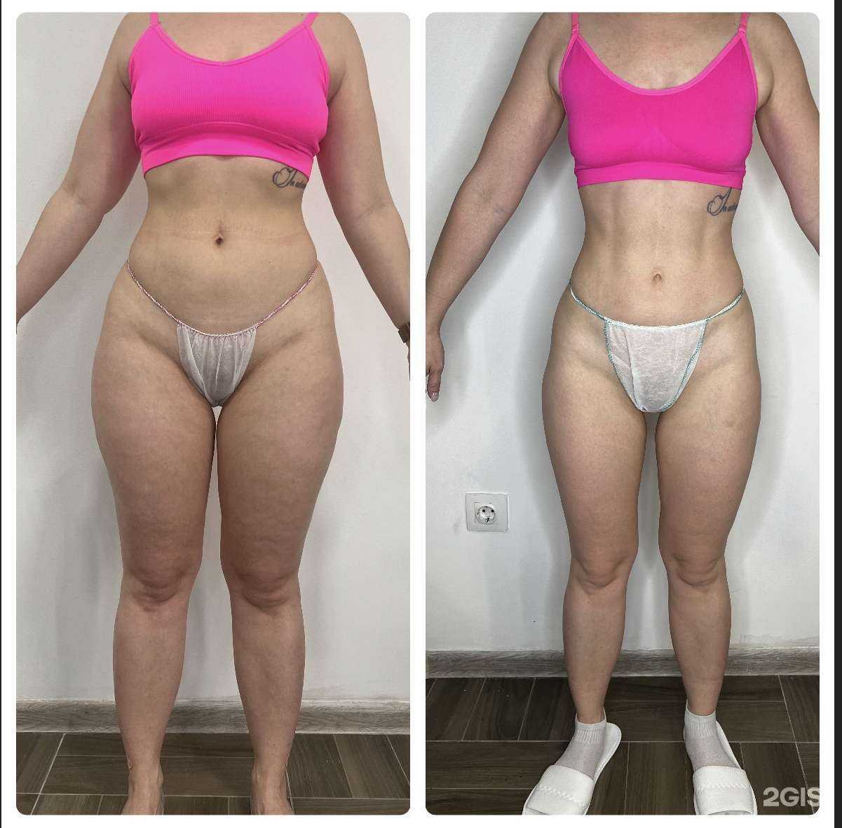 Отзывы на компанию За.Телом.КРД. в г. Краснодар c фото