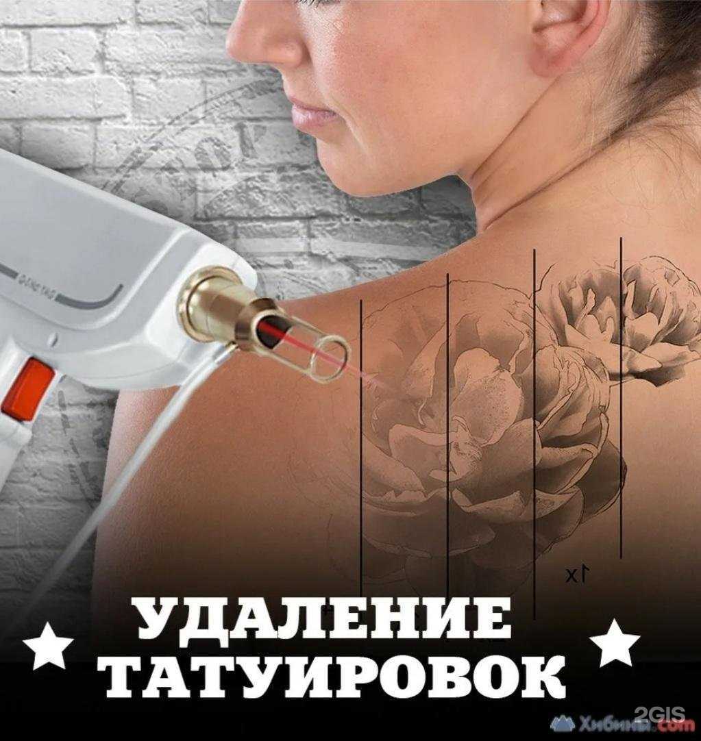 Отзывы на компанию Лазеръ в г. Ростов-на-Дону c фото