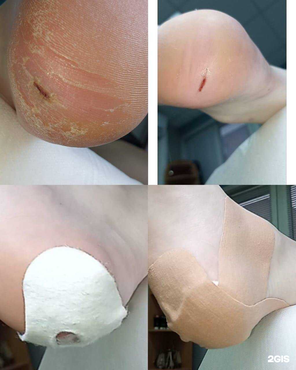 Отзывы на компанию Кабинет подолога в Волгограде c фото