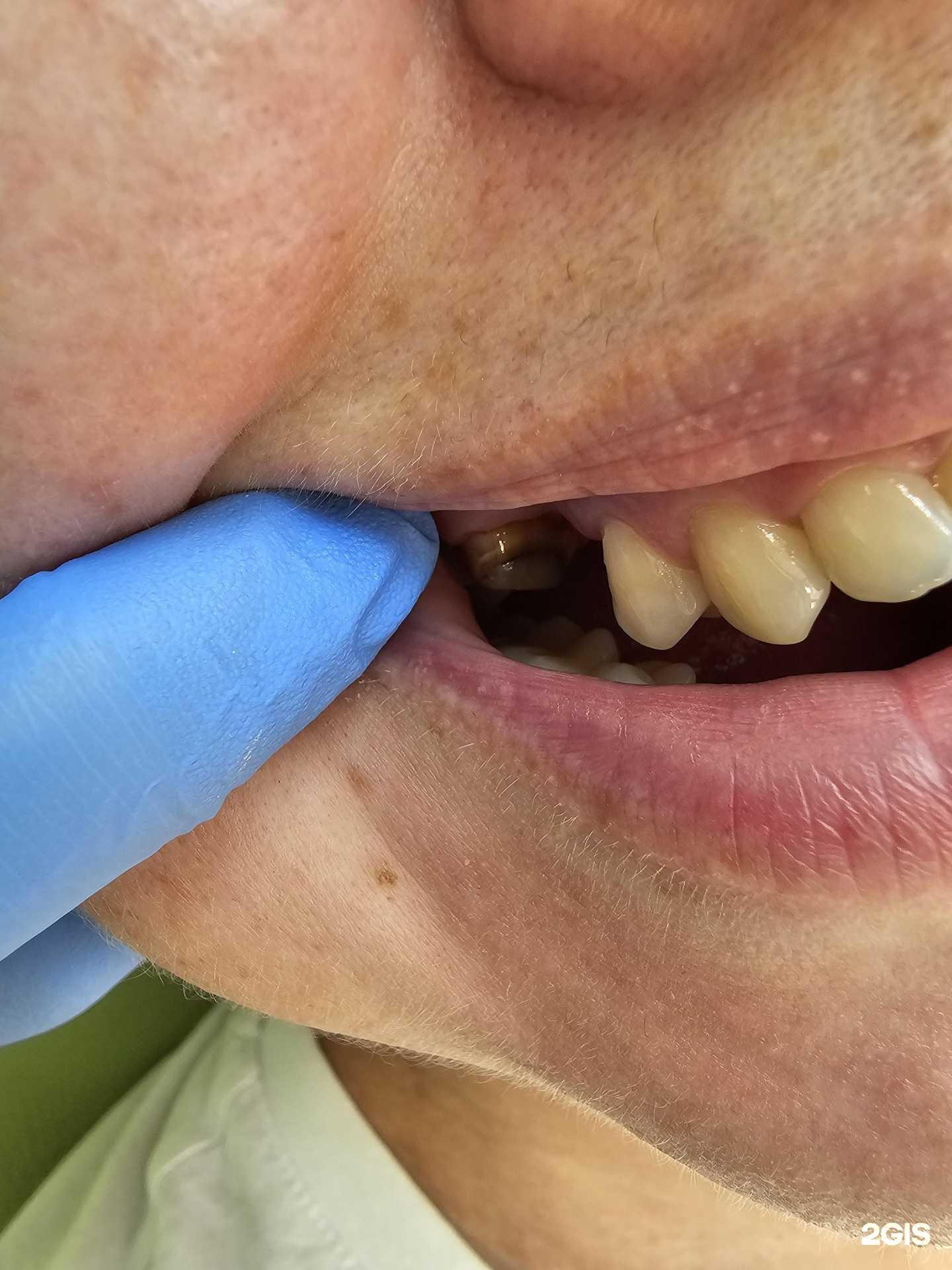 Отзывы на компанию Здоровый зуб в Челябинске c фото