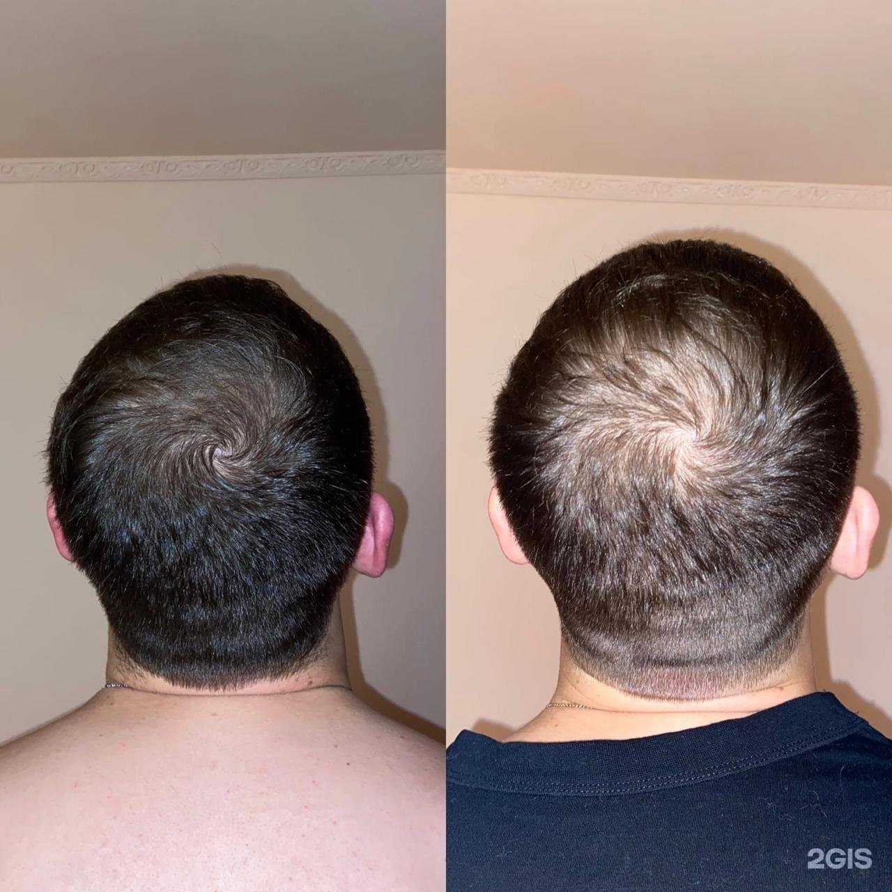 Отзывы на компанию Кабинет косметолога Увайсовой Мариям в Сургуте c фото