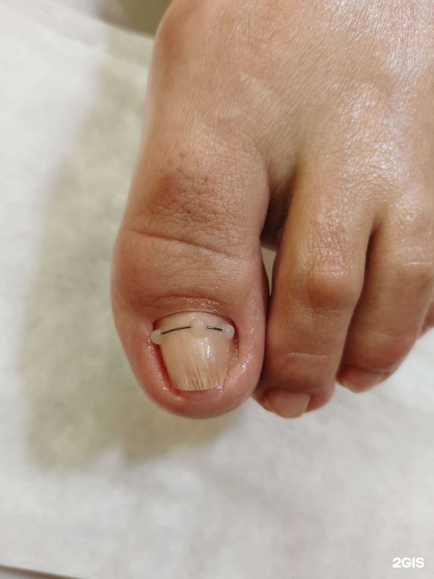 Отзывы на компанию Подологическая практика в Краснодаре c фото