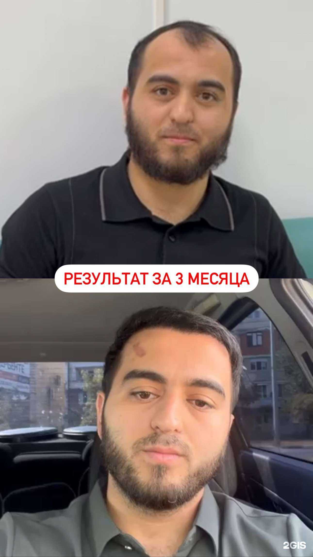 Отзывы на компанию Usisha hair clinic в Махачкале c фото