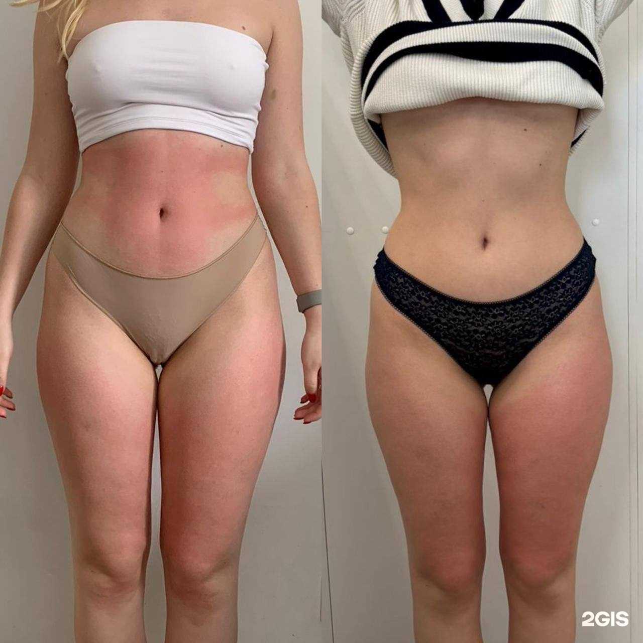 Отзывы на компанию На массаж в Омске c фото